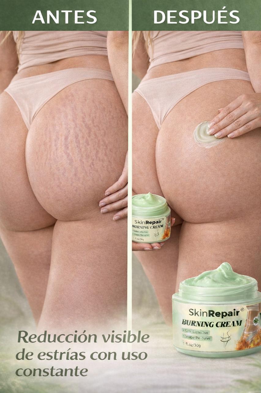 CREMA ANTIESTRÍAS SKINREPAIR