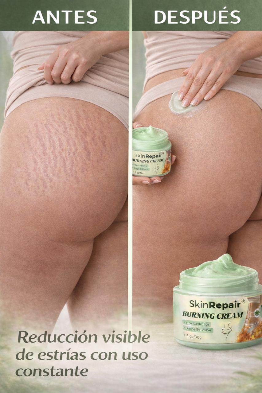 CREMA ANTIESTRÍAS SKINREPAIR