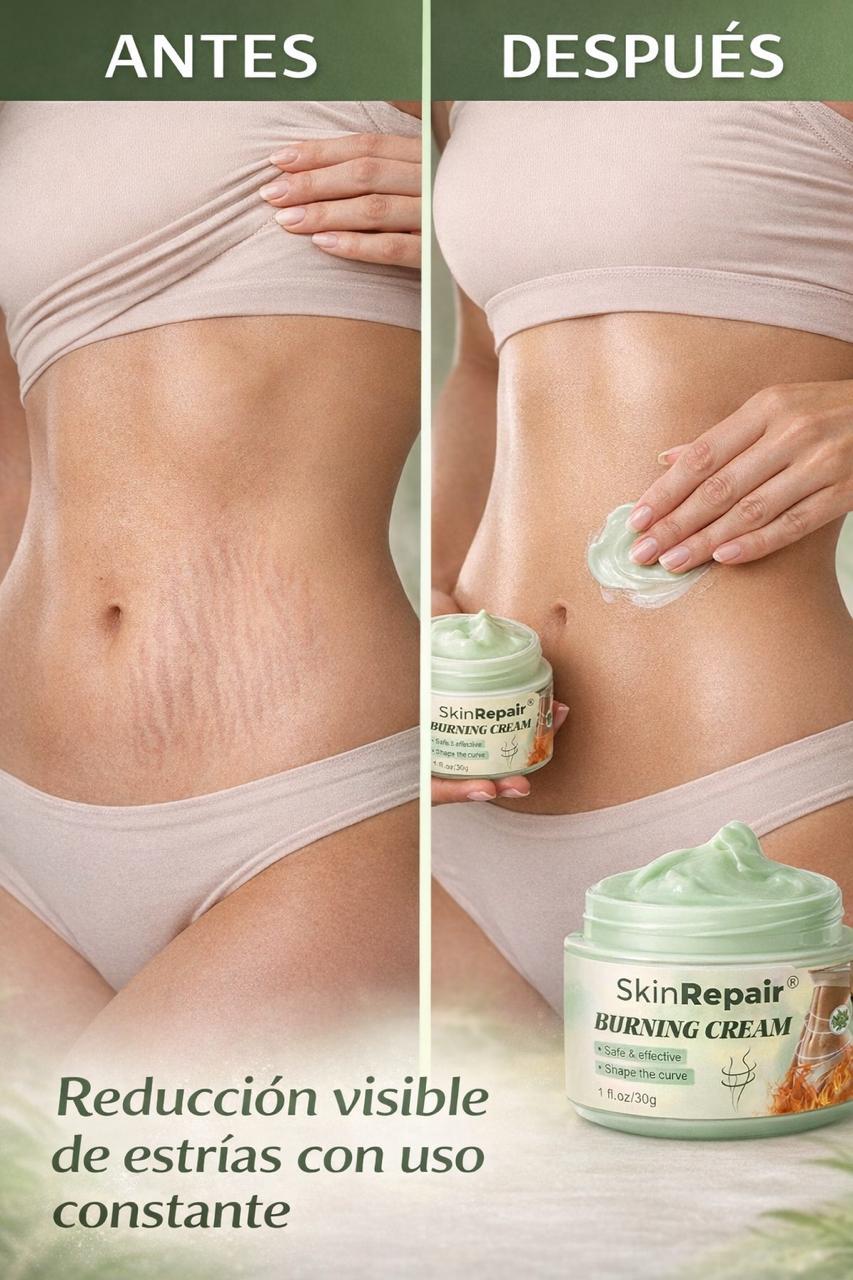 CREMA ANTIESTRÍAS SKINREPAIR