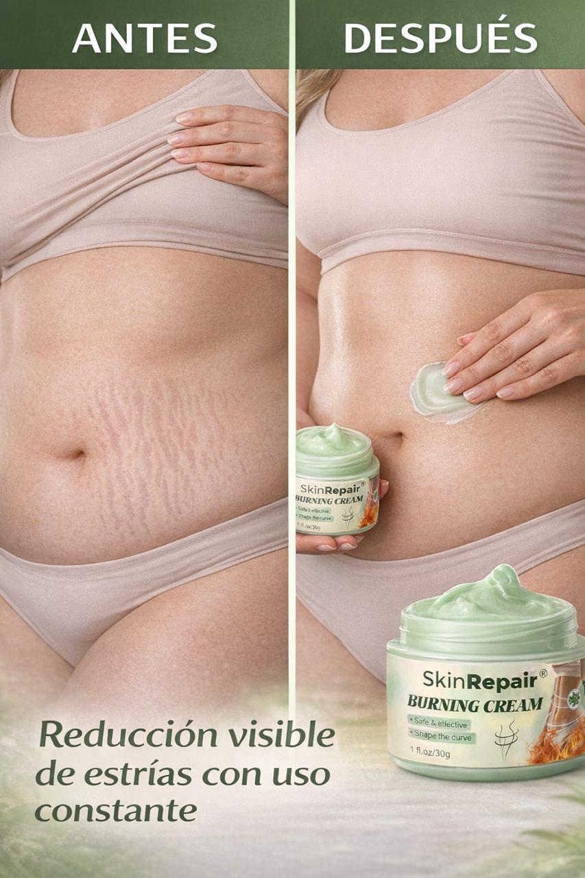 CREMA ANTIESTRÍAS SKINREPAIR