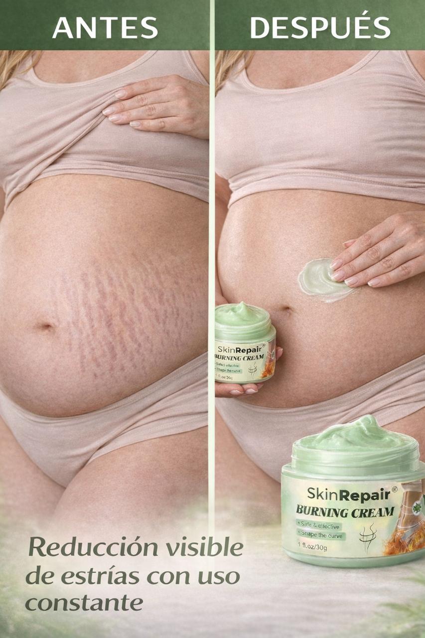 CREMA ANTIESTRÍAS SKINREPAIR